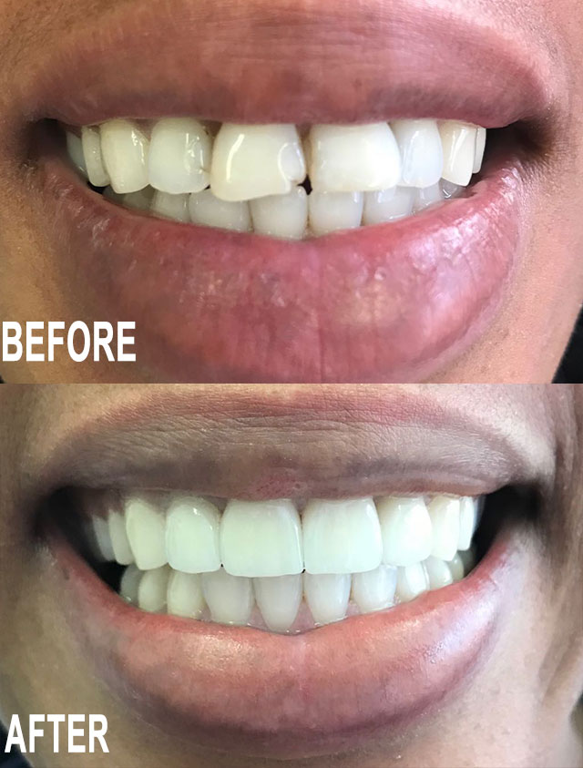 Before & After by Dr Ignus Terblanche