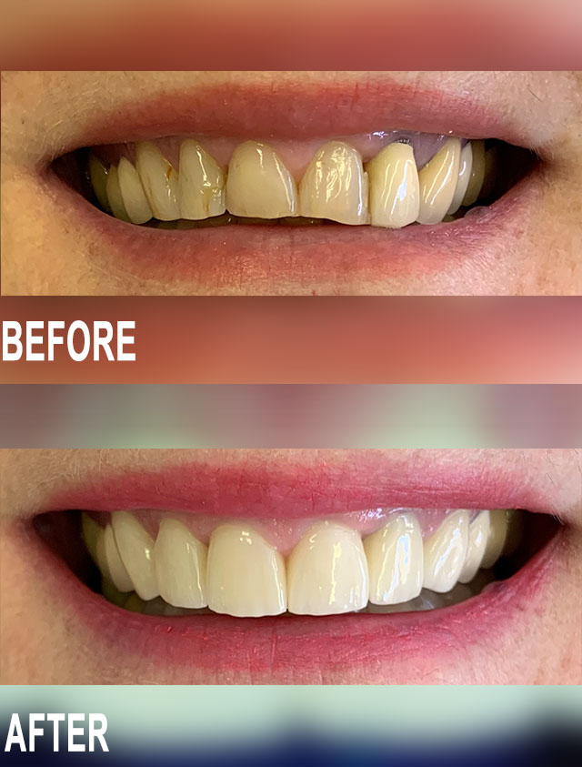 Before & After by Dr Ignus Terblanche